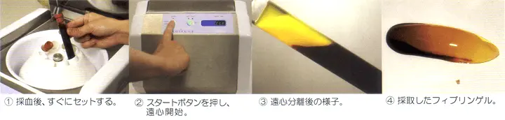 再生医療