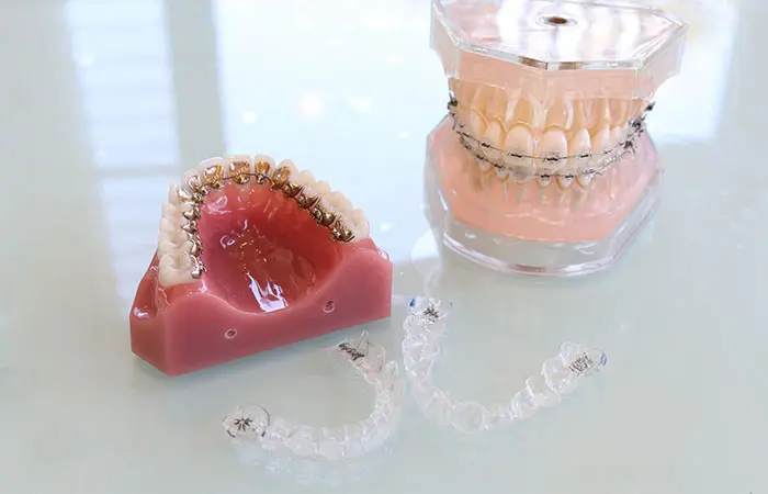 矯正歯科