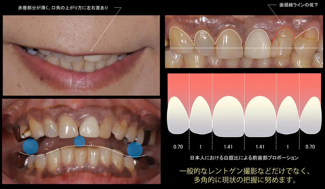 FTA治療