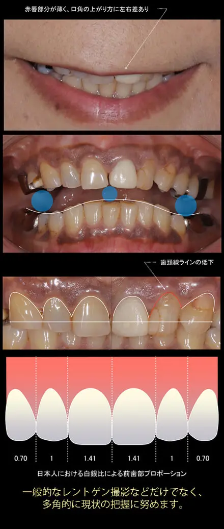 FTA治療