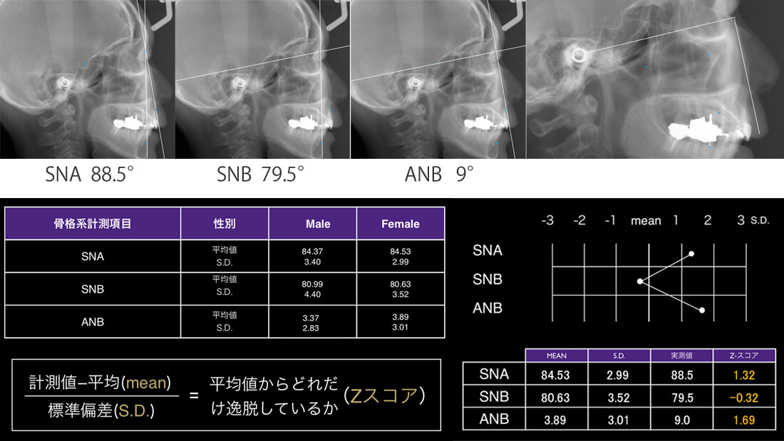 骨格系の計測