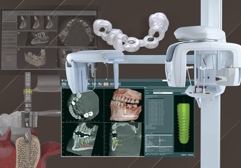 歯科用CTによる正確な診断