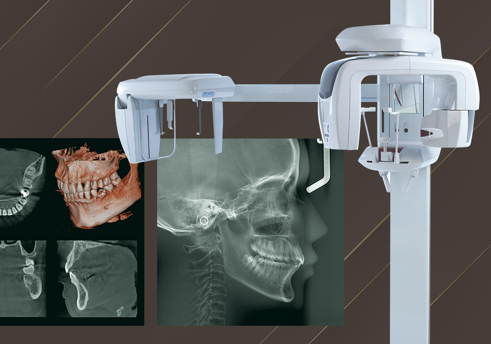 セファロ付き歯科用CT