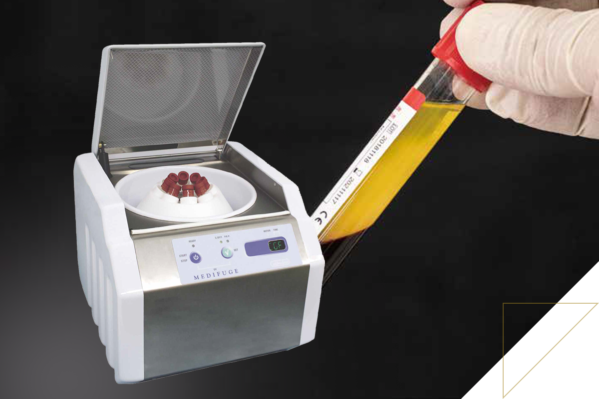 遠心分離機と再生医療